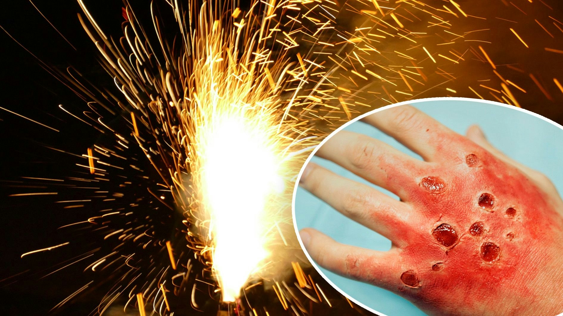 Heute.at - Das sind die häufigsten Gründe für Feuerwerksunfälle