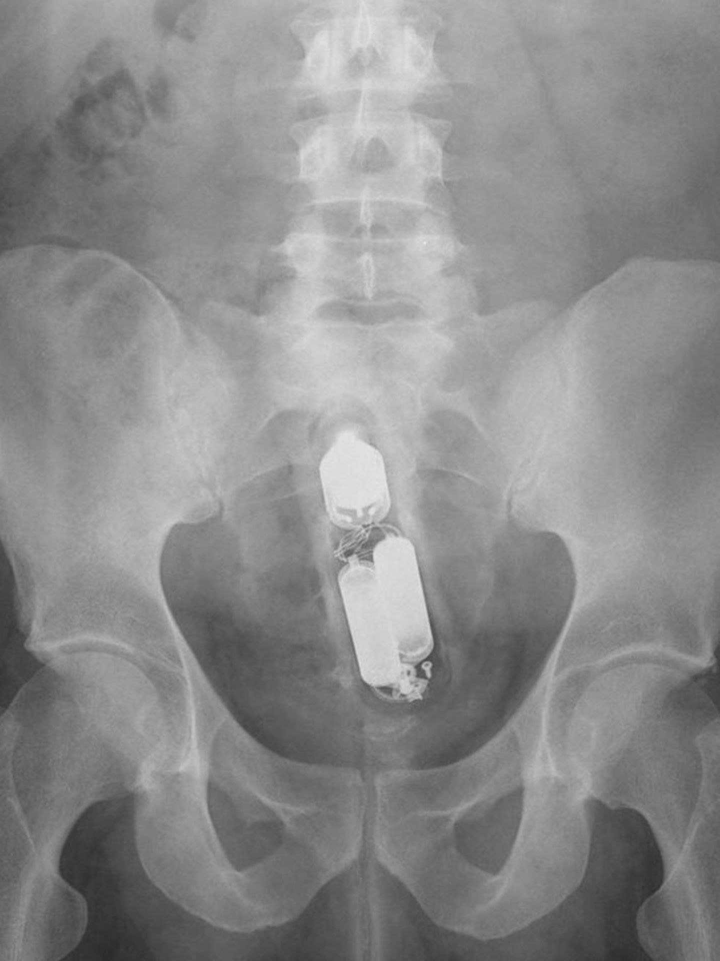 An den Batterien zu erkennen: ein Vibrator