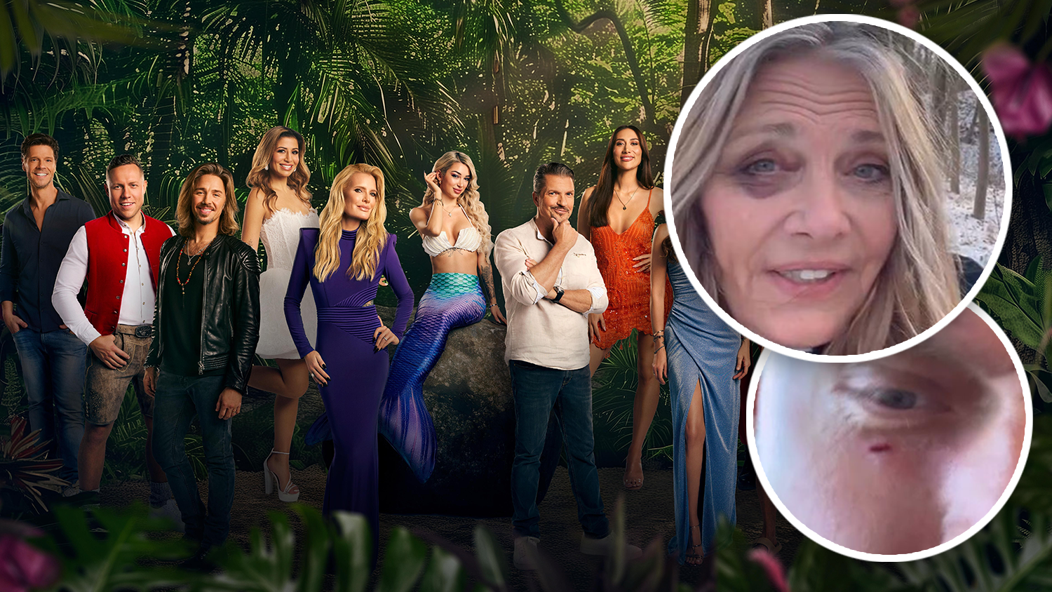 Heute.at - Dschungelcamp-Drama vor Abflug: Zwei Stars verletzt!