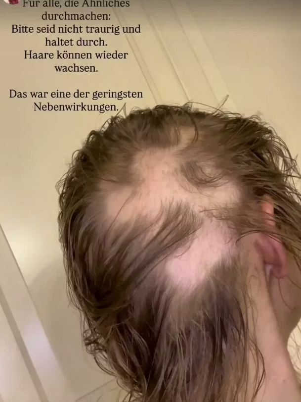 Patrice Aminati teilt ehrliche Einblicke in ihrem Kampf gegen Krebs.