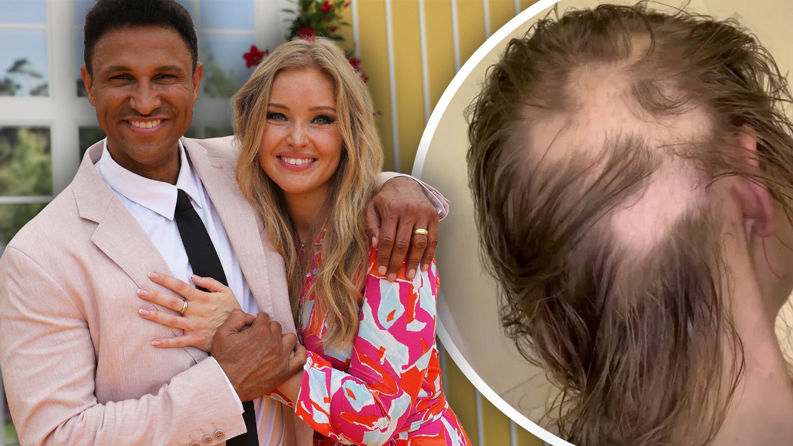 Heute.at - Haare wachsen nach – Patrice Aminati will Mut machen