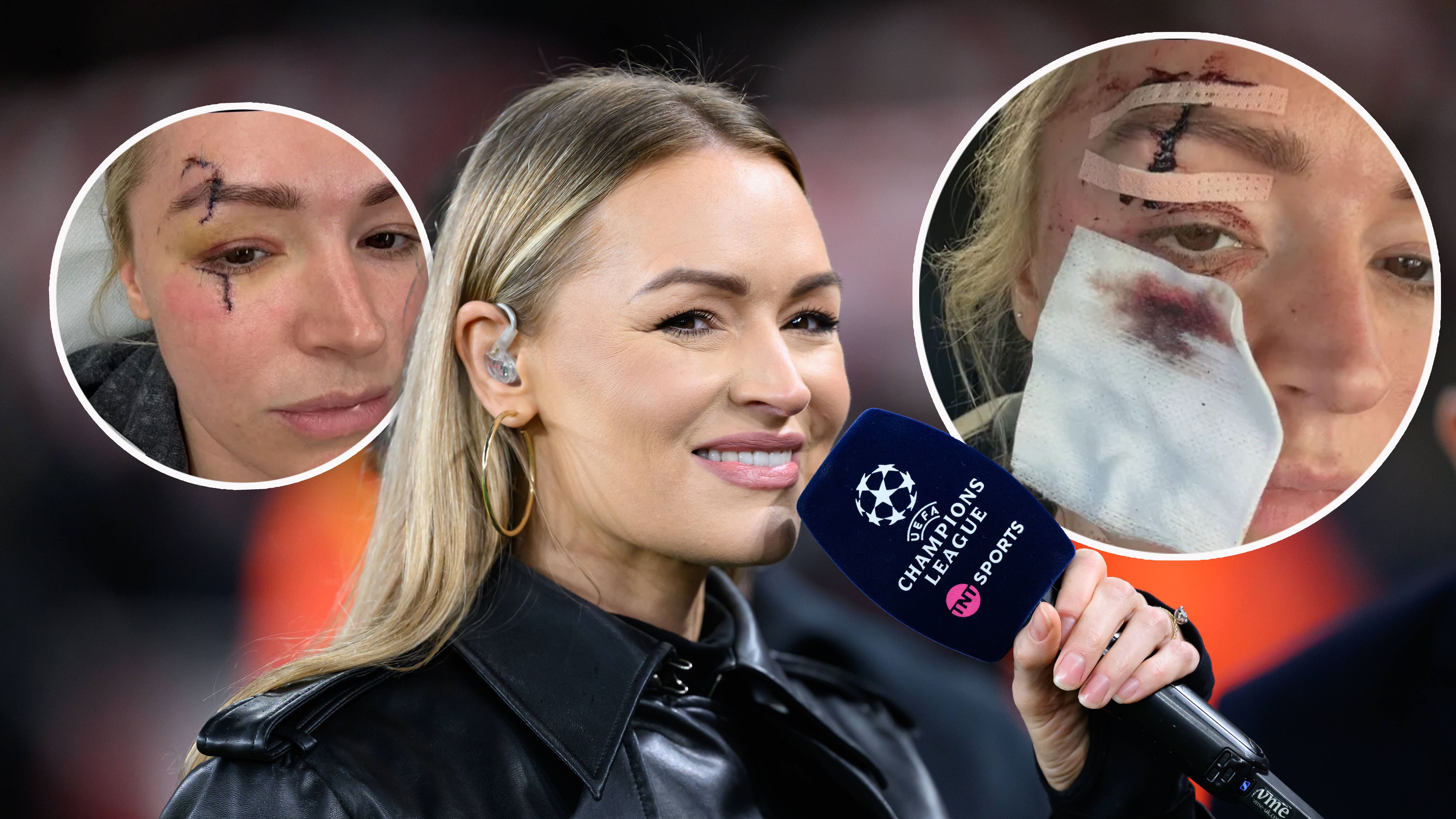 Heute.at - TV-Star übel zugerichtet – Schnitte bis zum Knochen