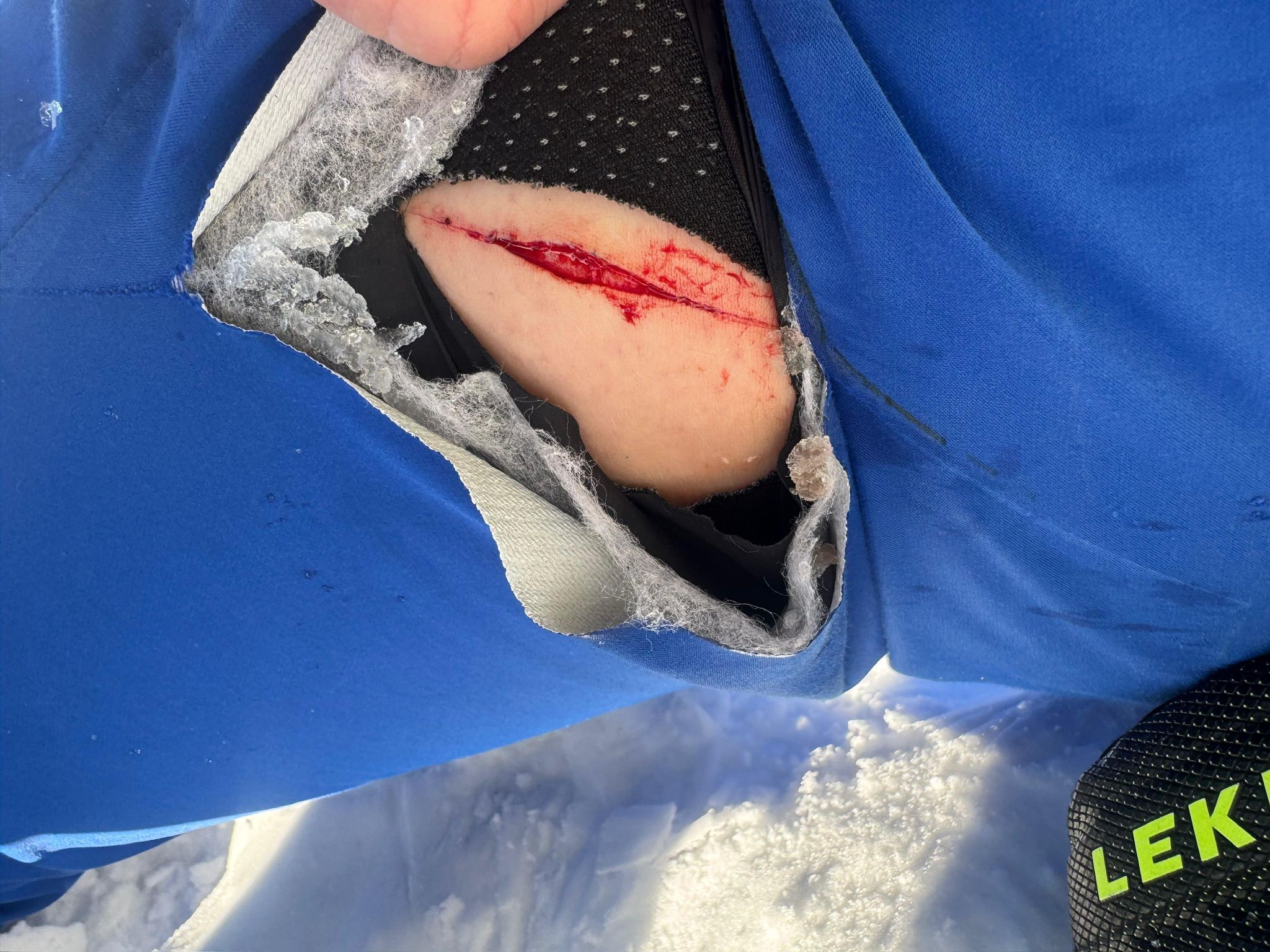 Mit diesem Wunde wurde der Patient aus dem medizinischen Zentrum in Gänserndorf weggeschickt.