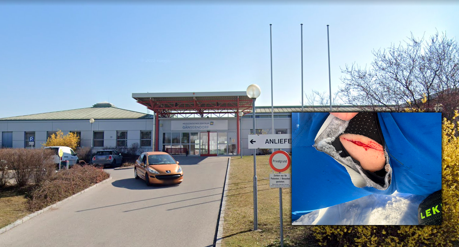 Mit dieser Wunde wurde ein 25-Jähriger abgewiesen.