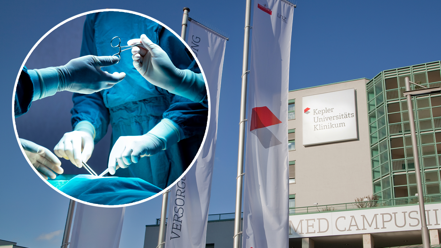 Am Linzer Kepler Klinikum soll einer jungen Frau die gesunde Gebärmutter entfernt worden sein. (Symbolbild)