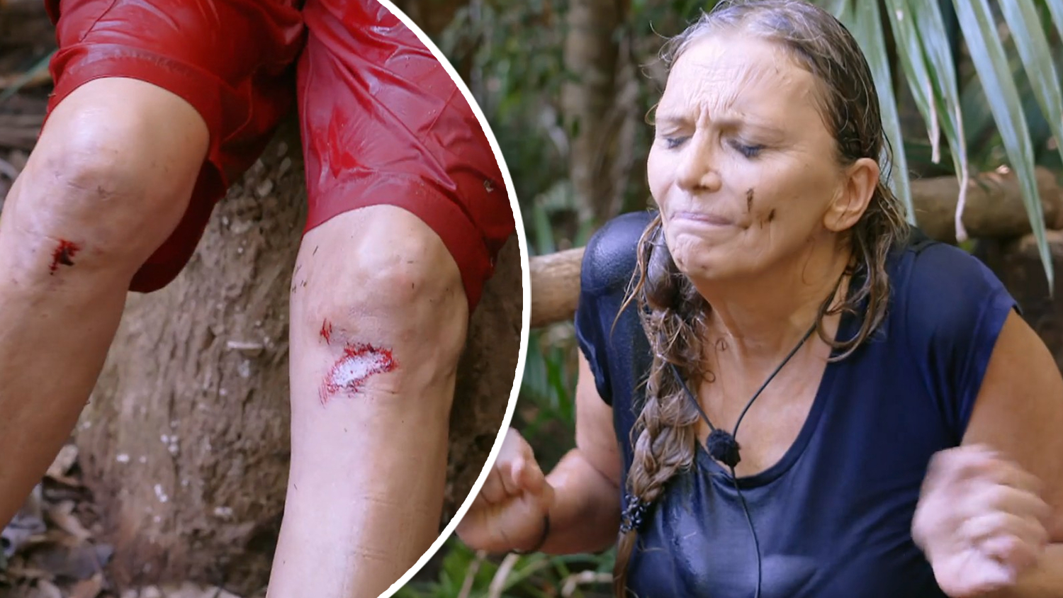 Nicole Belstler-Boettchers zog sich auf dem Rückweg ins Camp aufgeschürfte Knie zu.