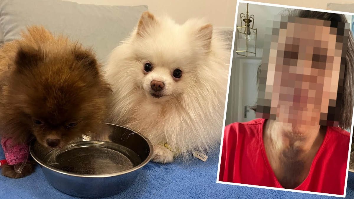 Heute.at - Durch Hölle gegangen – Attacke auf kleine Zwergspitze