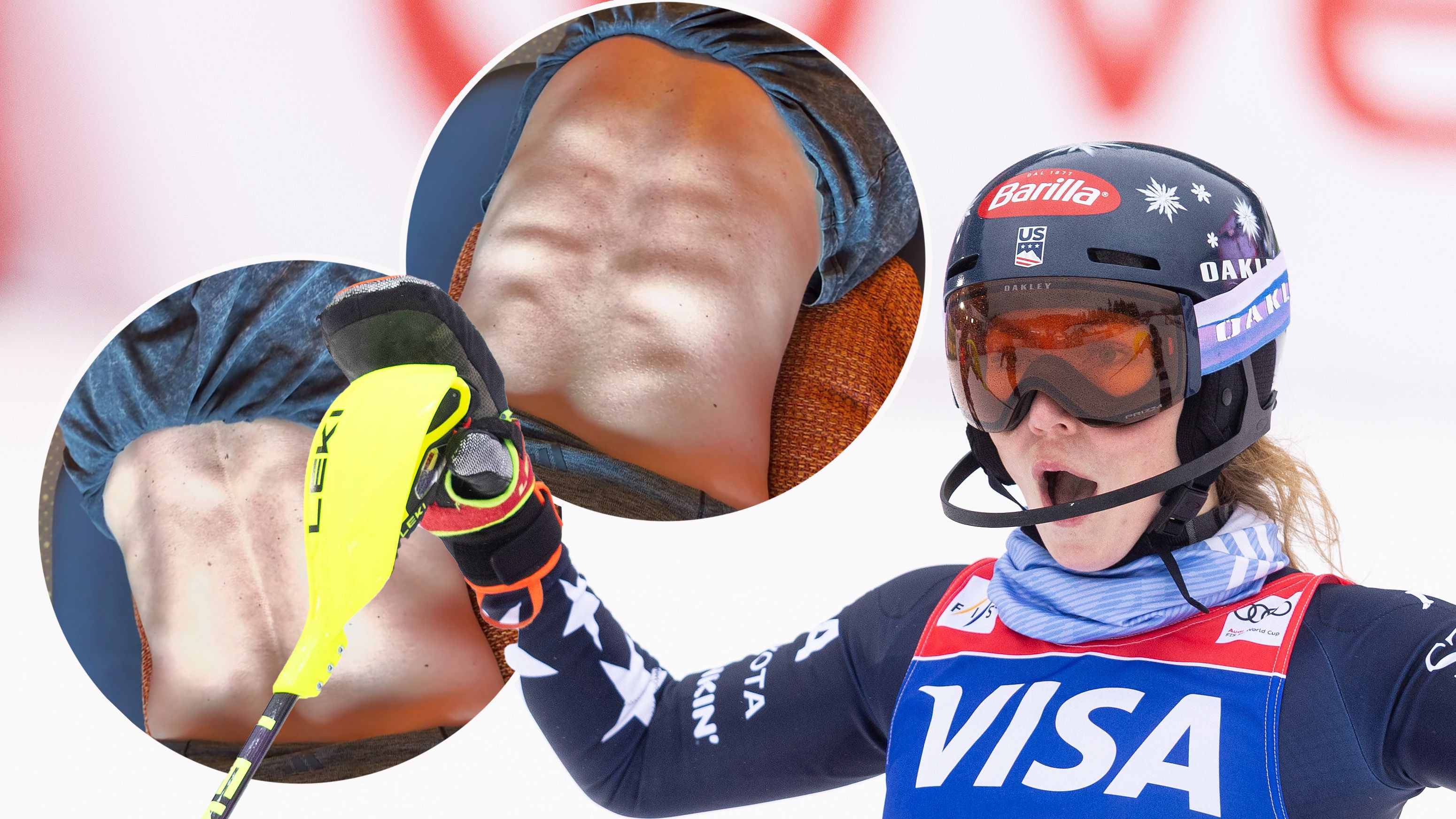 Mikaela Shiffrin zeigt ihre beeindruckende Rückenmuskulatur.