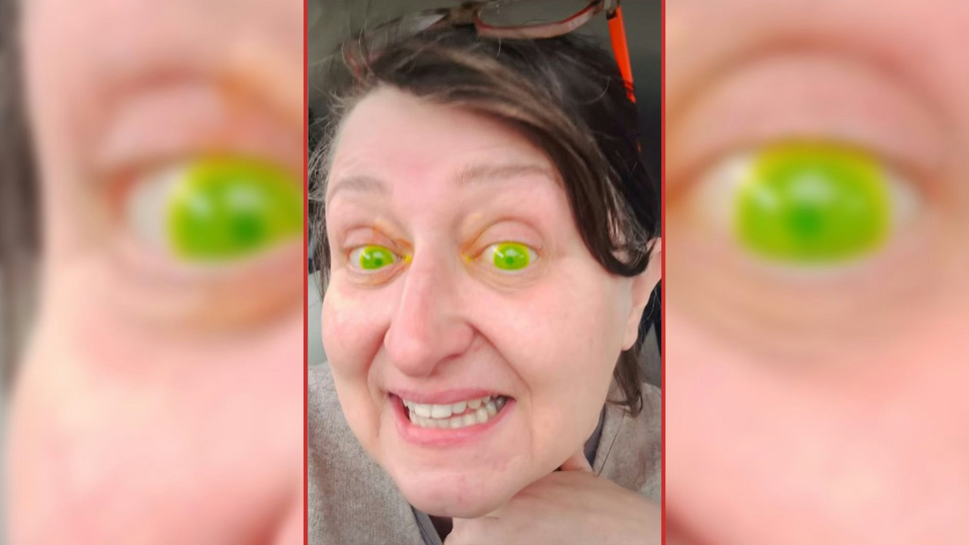 Heute.at - Nach Arztbesuch hat Margerita plötzlich neongrüne Augen