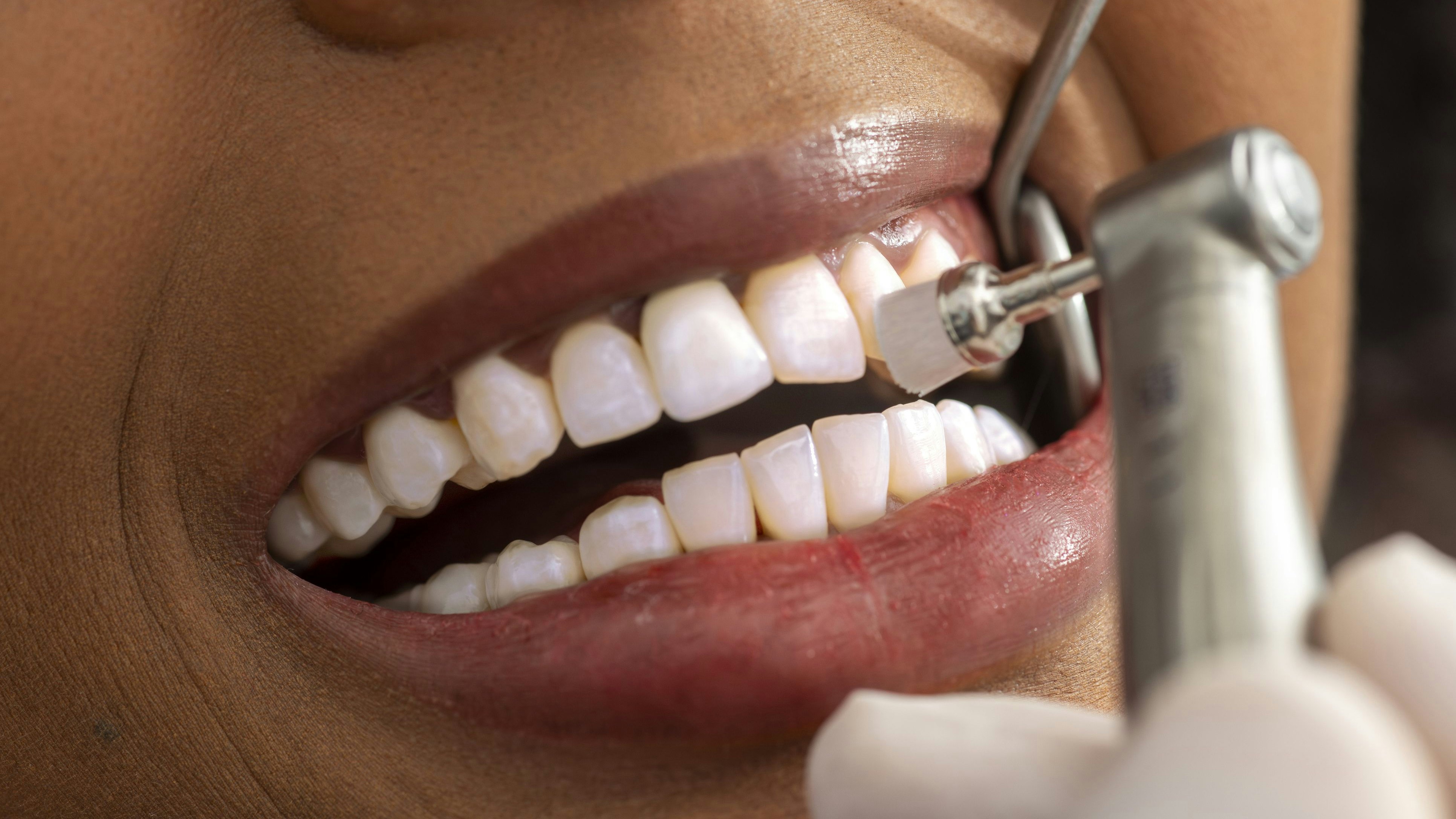 Heute.at - Zahnärztin verrät, was du den Zähnen nie antun solltest