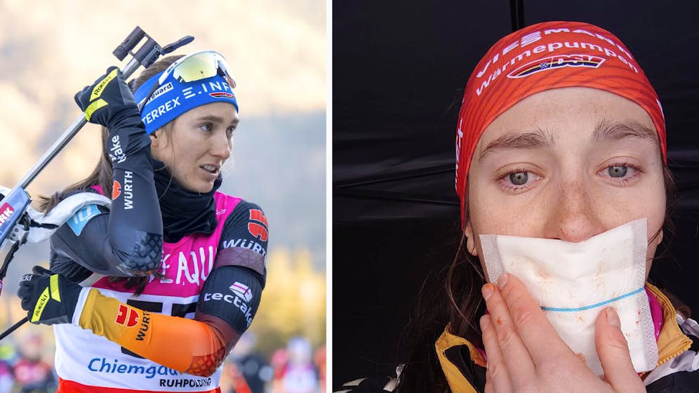 Juliane Frühwirth riss sich einen Teil ihrer Zunge ab.