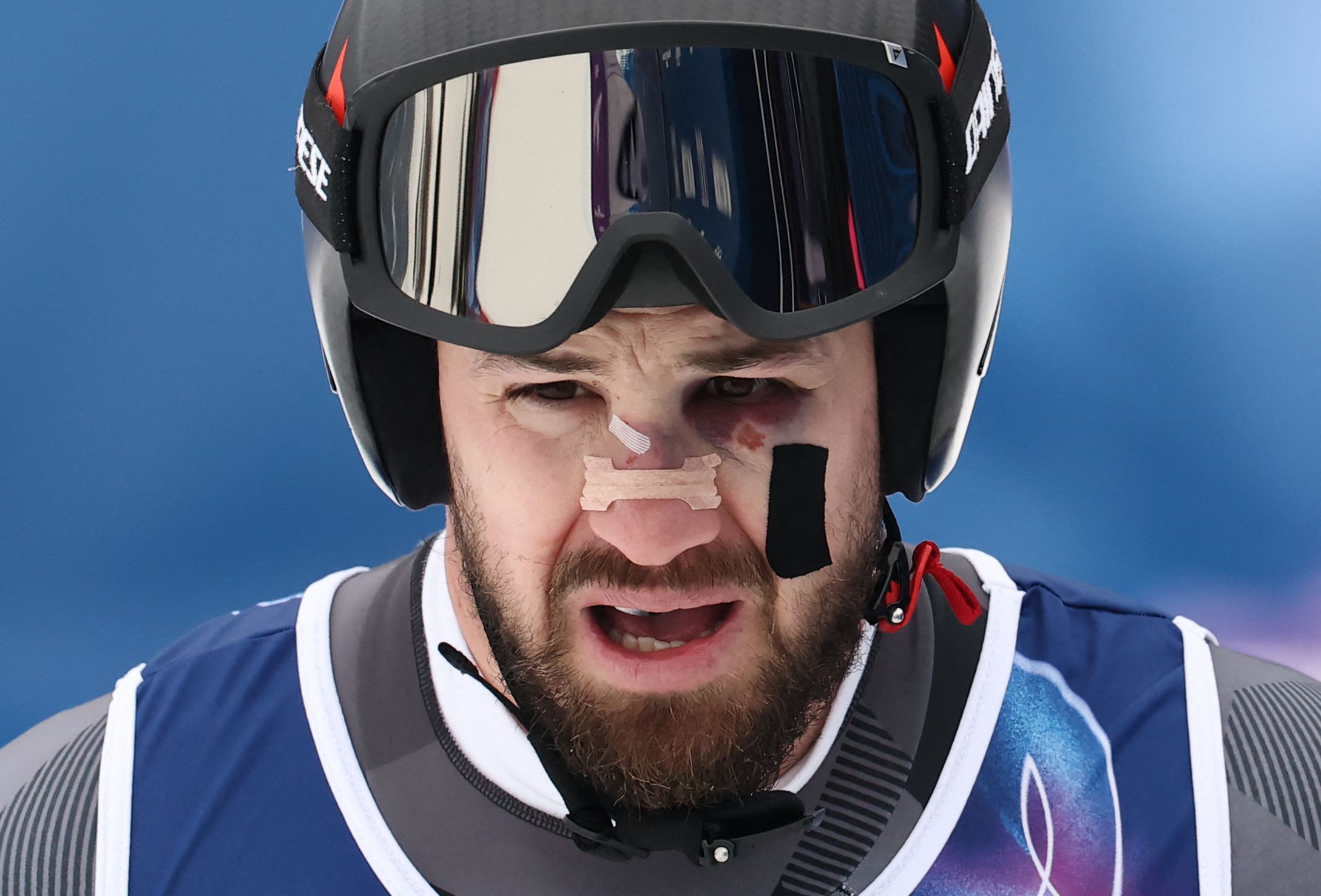 Daniel Hemetsberger ging von seinem Sturz gezeichnet, ins letzte Training. 