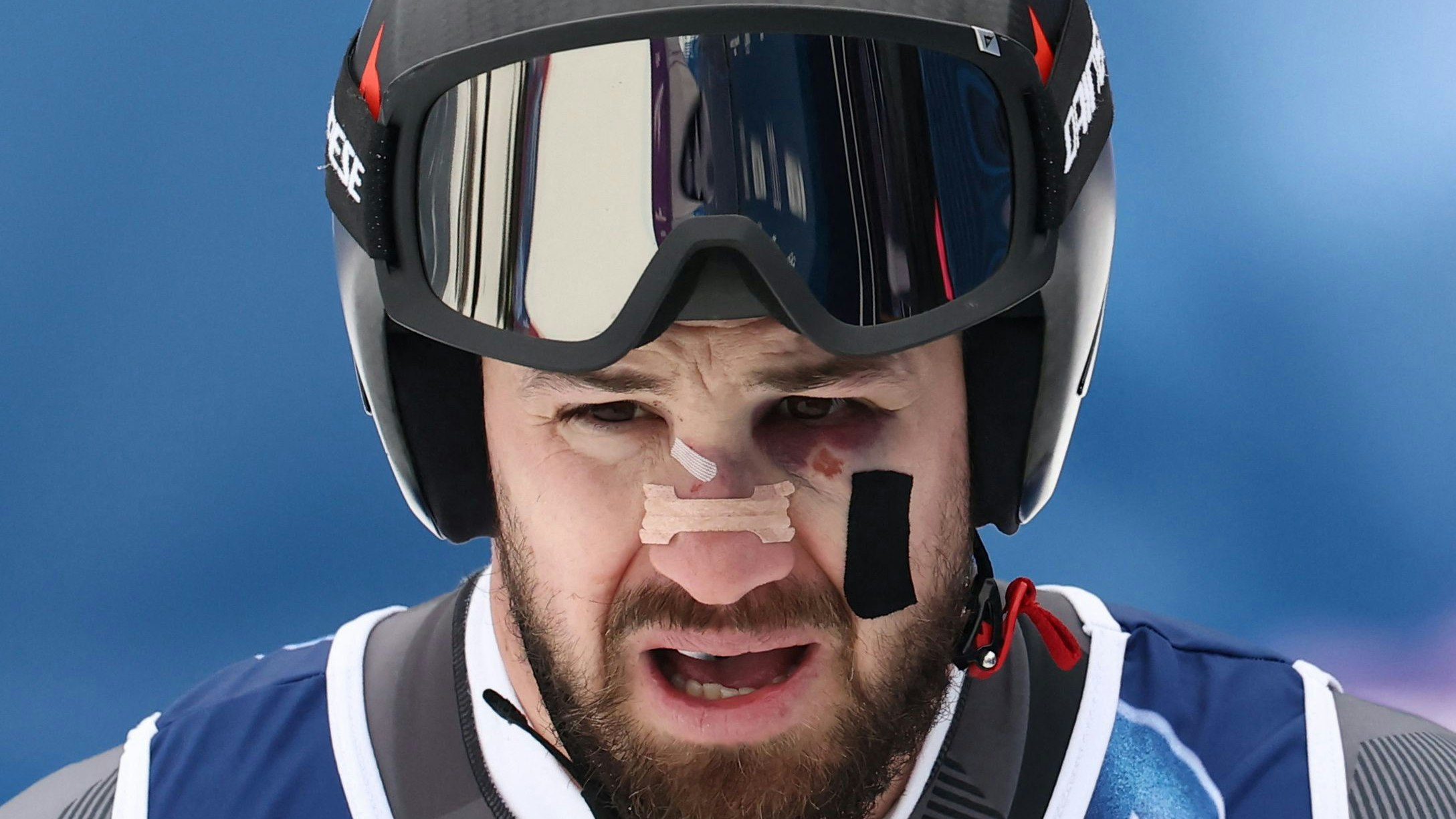 Daniel Hemetsberger ging von seinem Sturz gezeichnet, ins letzte Training. 