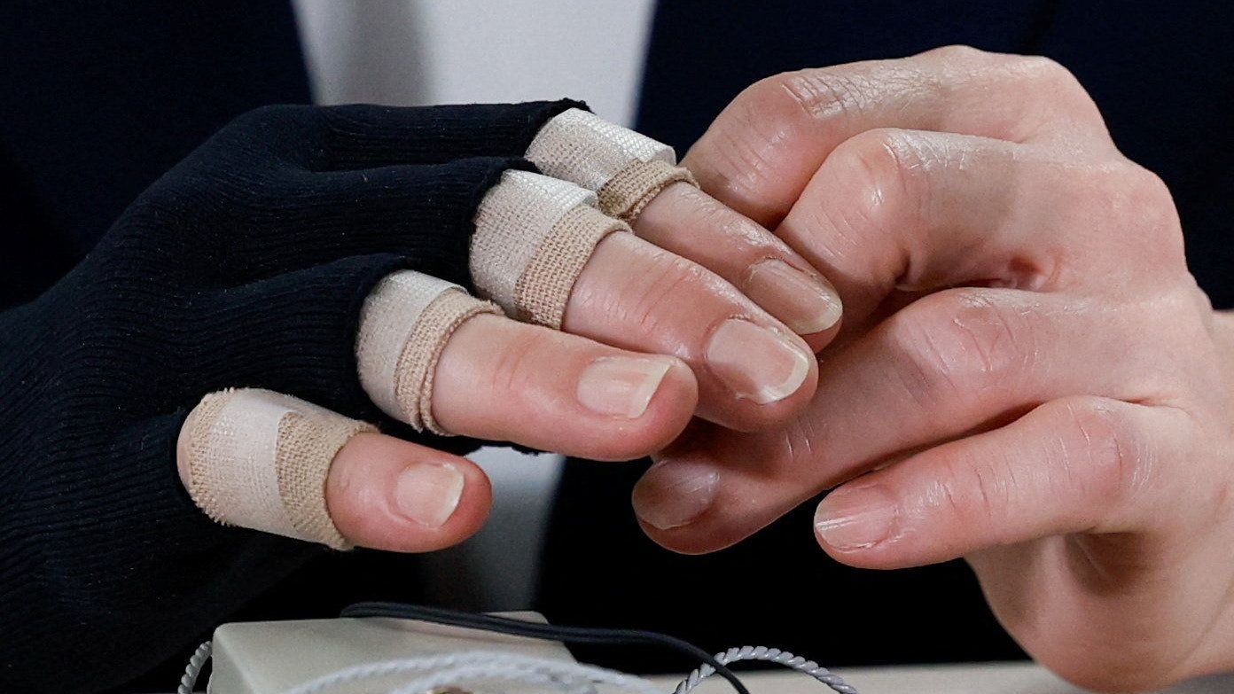 Takaichi leidet an rheumatoider Arthritis, nach dem vielen Händeschütteln im Wahlkampf trägt sie nun Verband