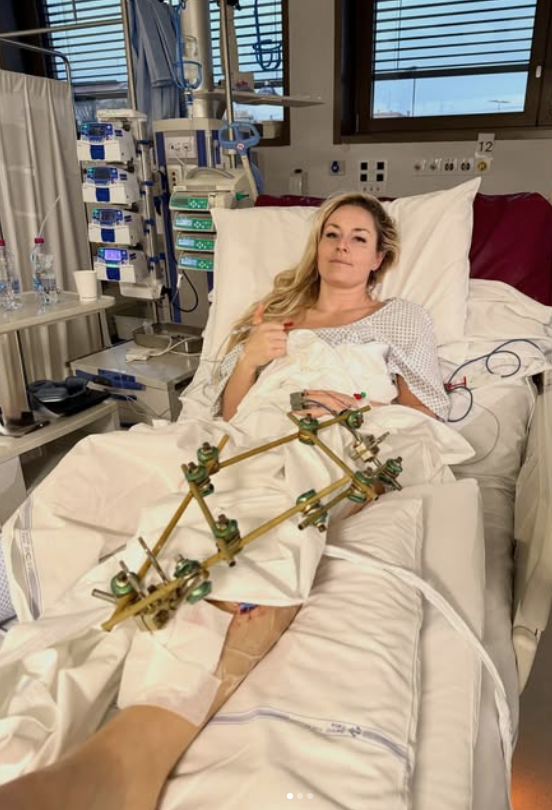 Lindsey Vonn mit ihrem kaputten Fuß nach OP Nummer drei.