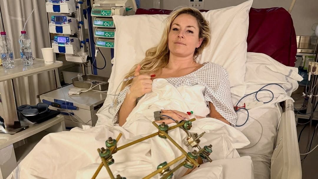 Ski-Star Lindsey Vonn meldet sich per Video aus dem Krankenhaus. 