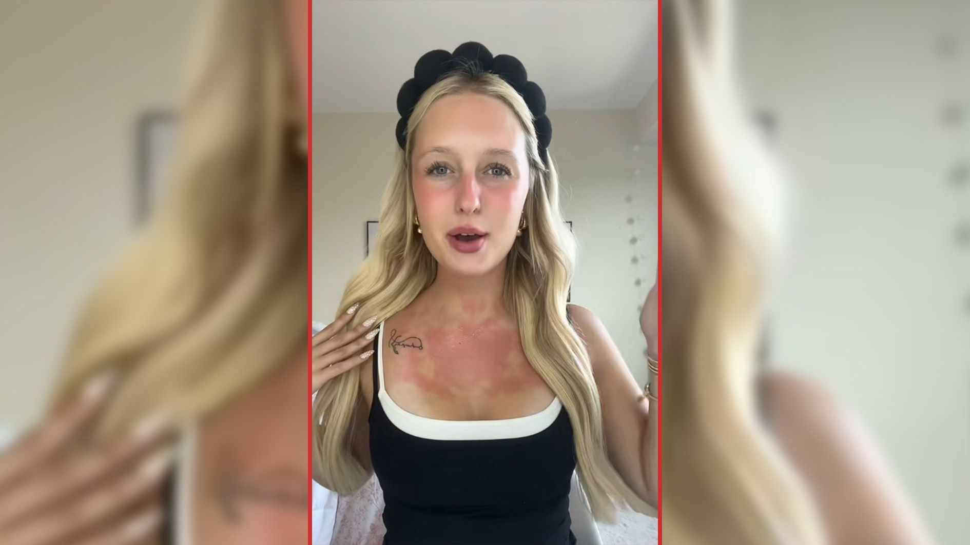 Dank Lipgloss zum Ausschlag – TikTokerin Hope Clarke zeigt in einem Clip, wie es geht.