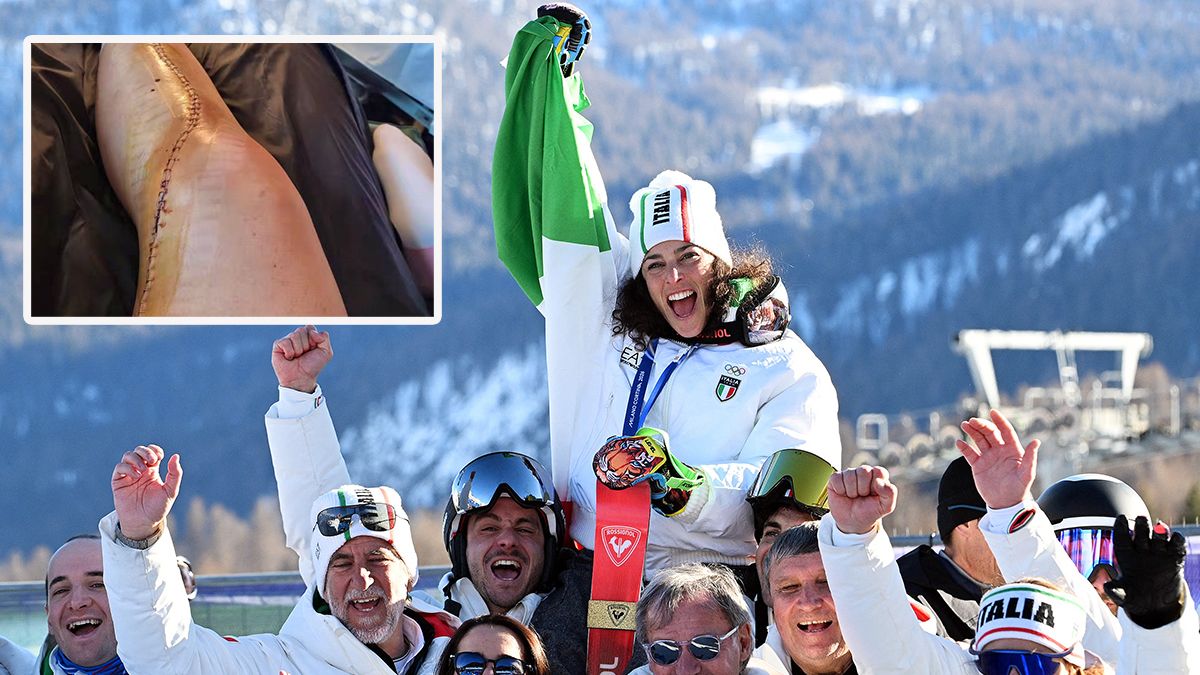 Federica Brignones Bein nach ihrer Verletzung im April.