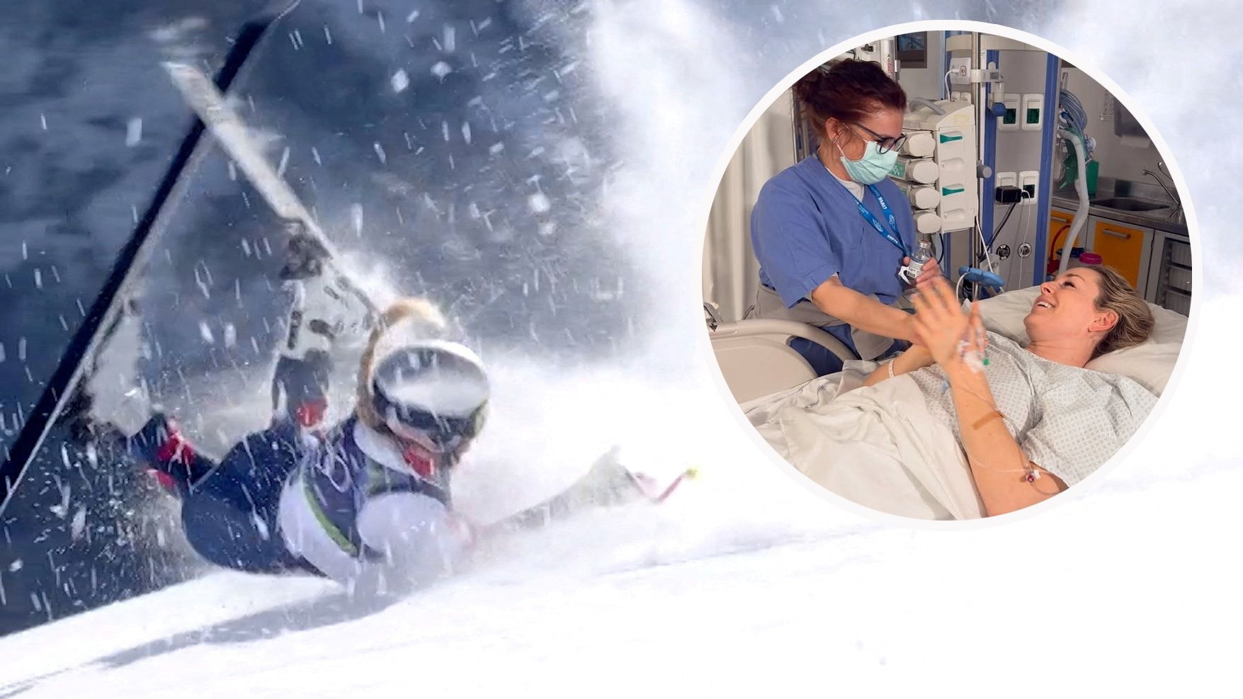 Der Olympia-Sturz von Lindey Vonn hatte bereits vier Operationen zur Folge. Eine fünfte wird mindestens dazukommen.