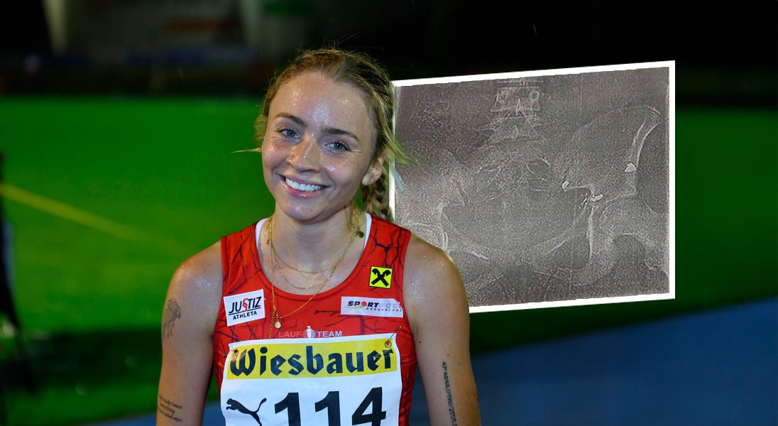 Caroline Bredlinger bei einem Wettkampf – trotz Kugel im Körper zählt sie zu den besten Athletinnen der Welt