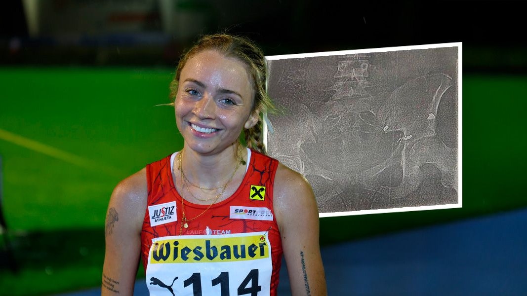Caroline Bredlinger bei einem Wettkampf – trotz Kugel im Körper zählt sie zu den besten Athletinnen der Welt