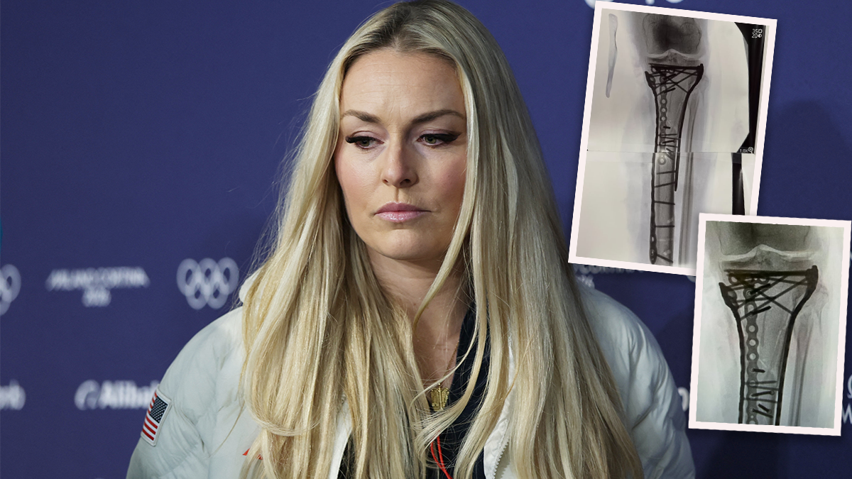 Ski-Star Lindsey Vonn meldete sich nach ihrer fünften Operation zu Wort. 