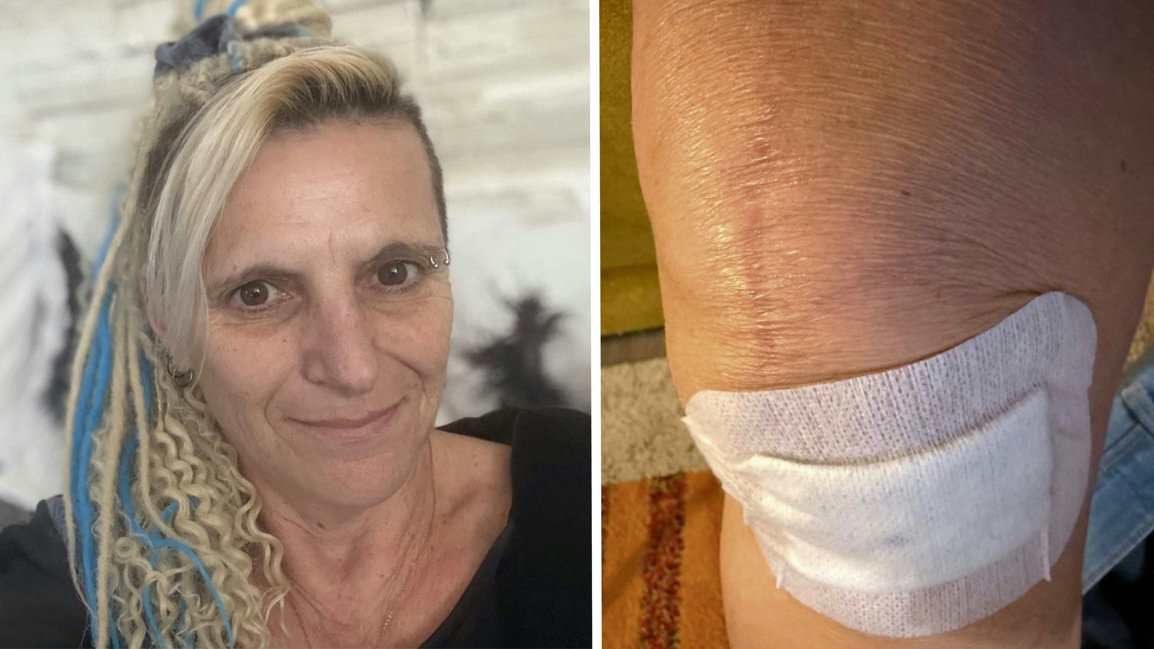 Heute.at - Frau mit Schmerzen nach Knie-OP: Spital weist mich ab