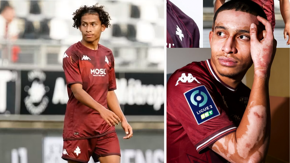 Tahirys Dos Santos erlitt schwere Verbrennungen.