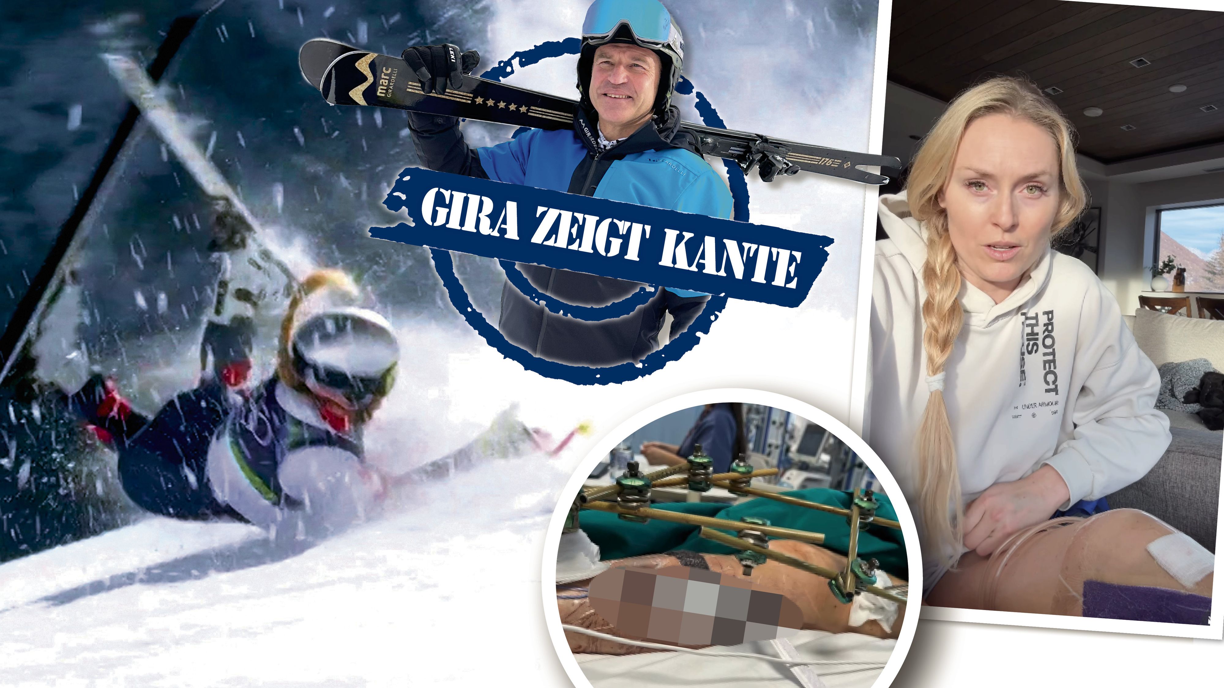 Heute.at - Girardelli: Bei Vonn geht nichts ohne Drama