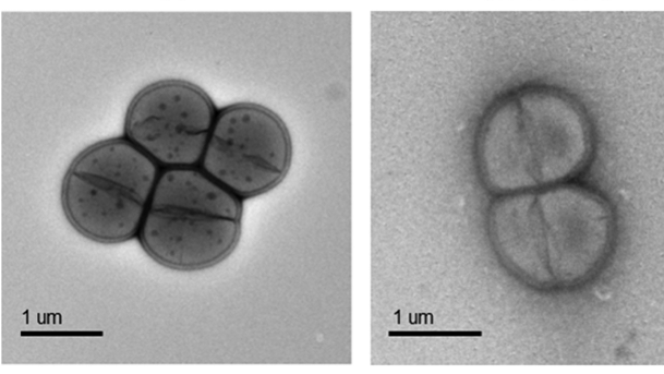 Bakterium Deinococcus radiodurans: Sahen so unsere Ur-Ur-Ur-Vorfahren aus?