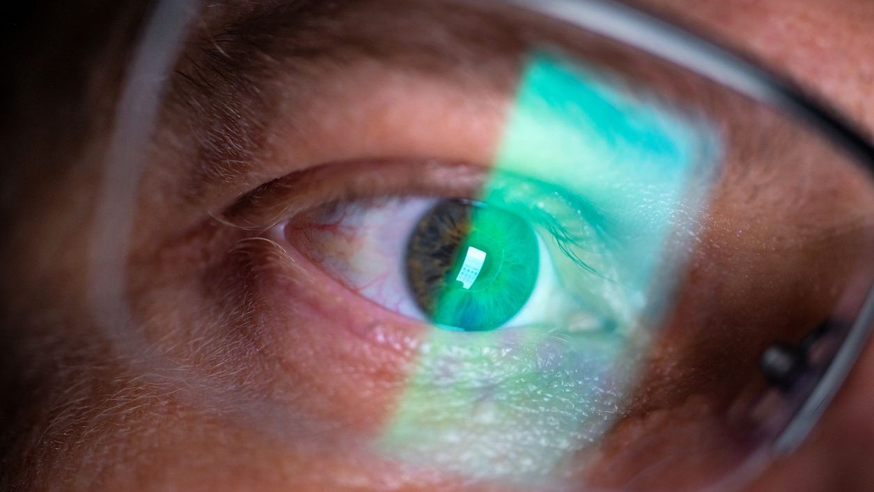 Heute.at - HealthAEye – Forscher entwickeln Handy-Test fürs Auge