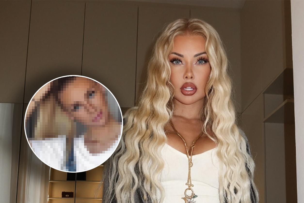 TV-Sternchen Sabrina Wlk warnt ihre Follower vor Beauty-Eingriffen.