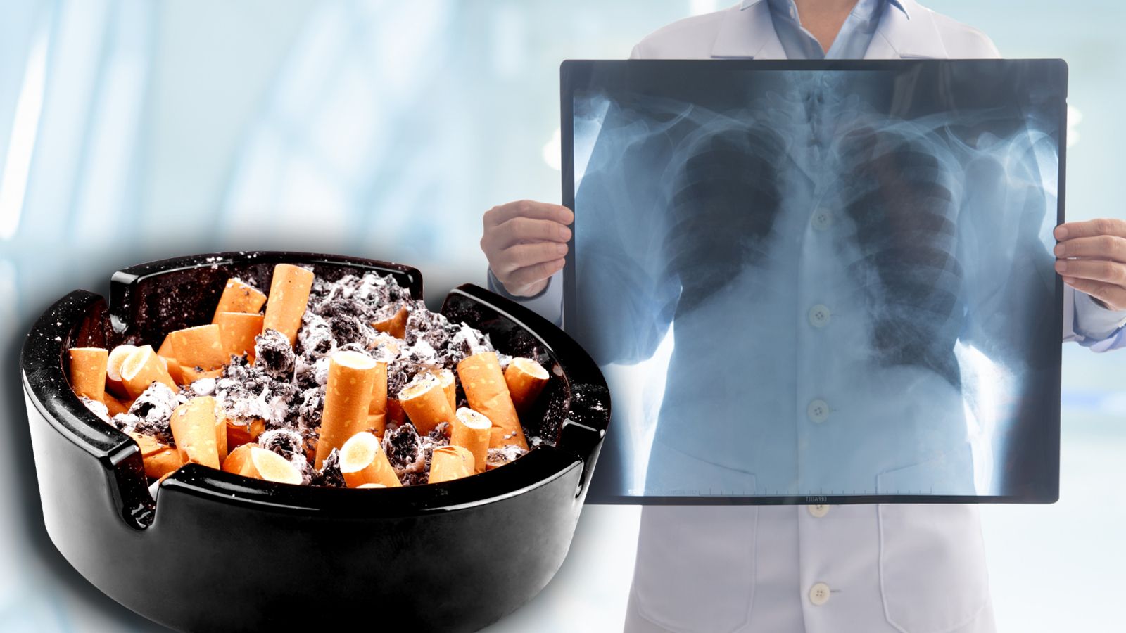 Nur jeder fünfte Lungenkrebsfall wird in Österreich früh erkannt. Experten fordern deshalb seit Jahren ein Screeningprogramm – Deutschland setzt es jetzt um.