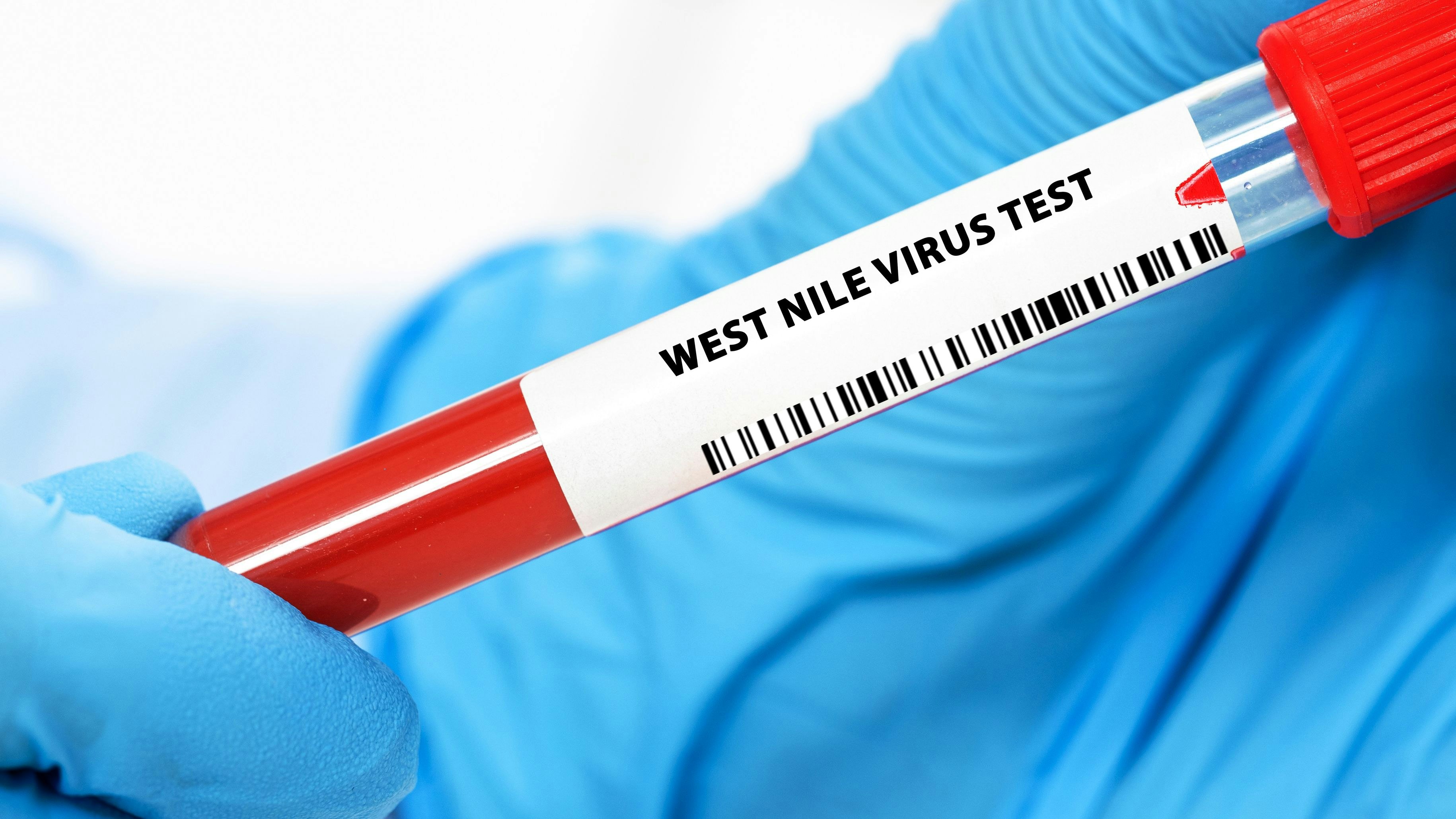 Das West-Nil-Virus grassiert auch in Europa immer mehr.