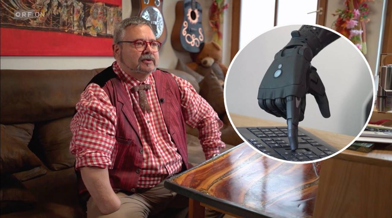 Michael G. benötigte die neue Prothese, um seinen Job ausüben zu können.