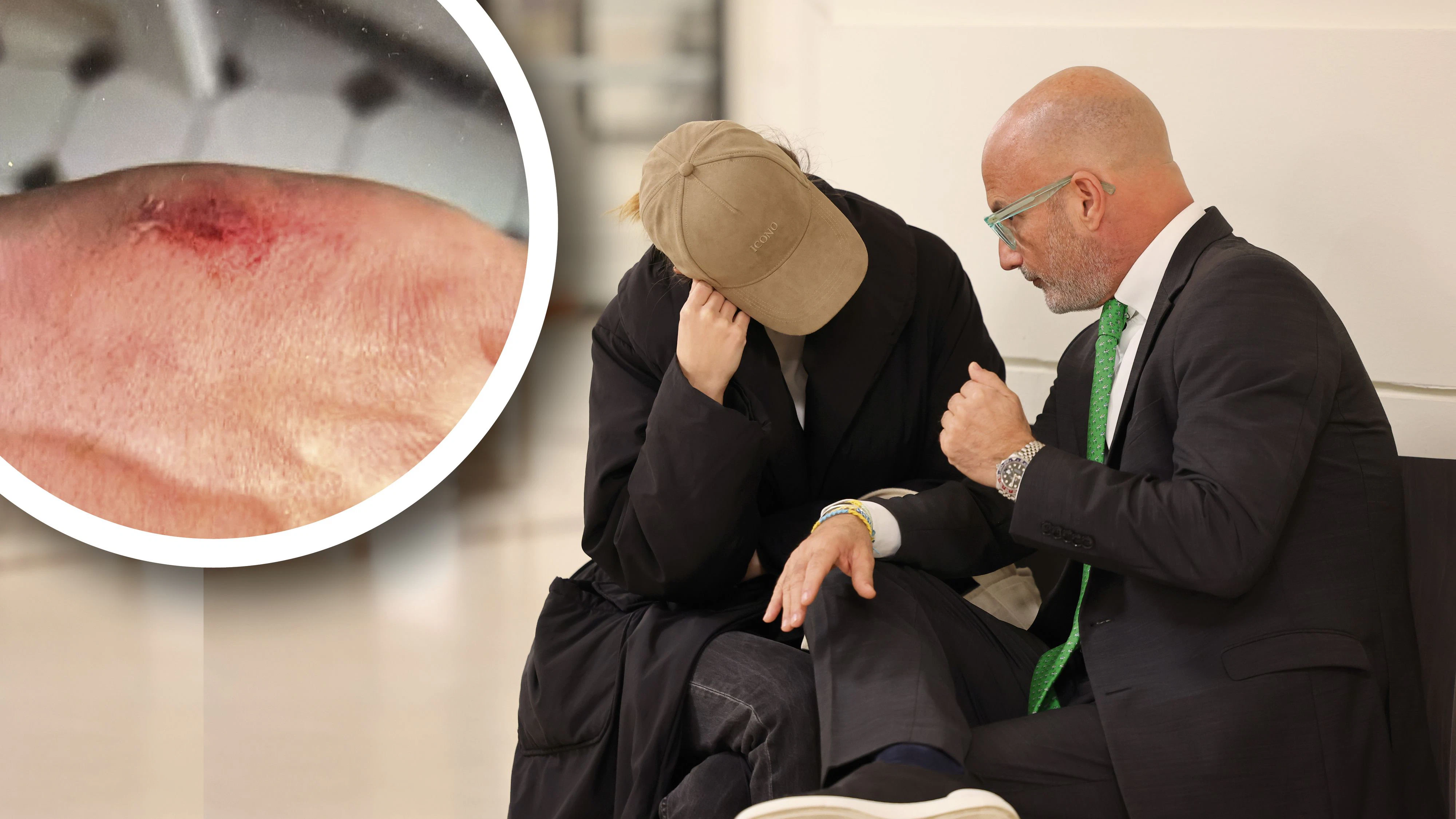 Heute.at - Beamten gebissen: darum verlor Ex von TV-Star Kontrolle