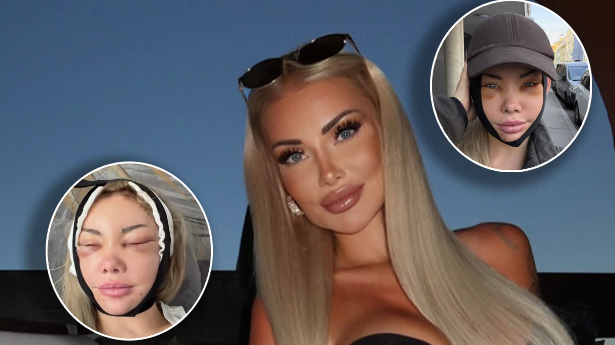 Heute.at - Reality-Star Sabrina Wlk zeigt ihr neues Gesicht