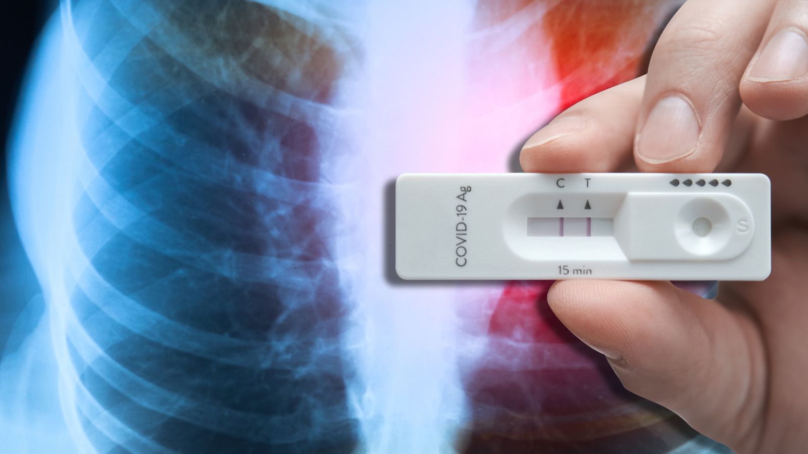 Eine Studie zeigt: Schwere Infektionen könnten das Risiko für Lungenkrebs erhöhen.