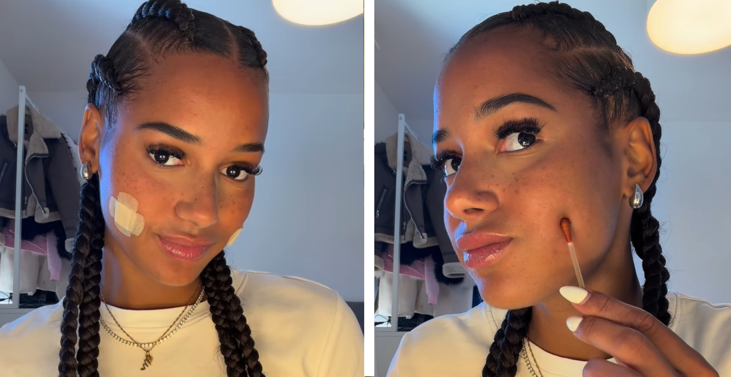 Reality-Star lässt sich Grübchen operieren.