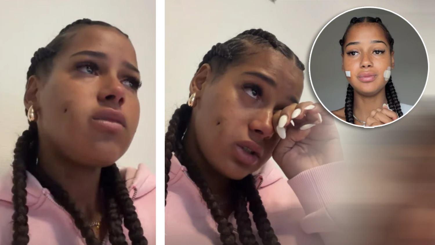 Heute.at - Reality-Star landet nach Grübchen-OP in Notaufnahme