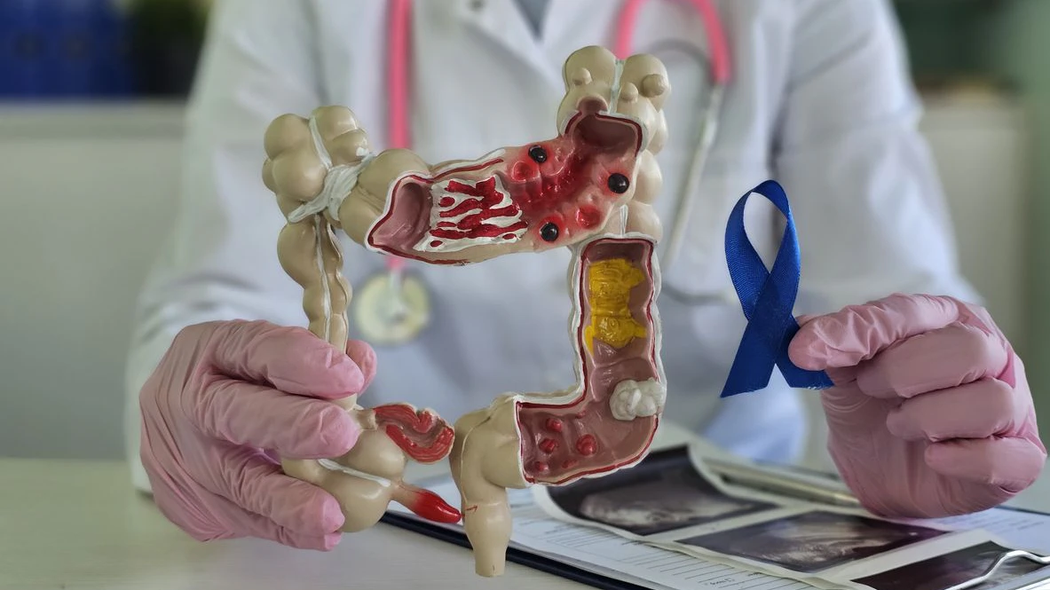 A healthcare professional demonstrates a digestive system model while holding a blue awareness ribbon, emphasizing the importance of gut health in a clinical environment.