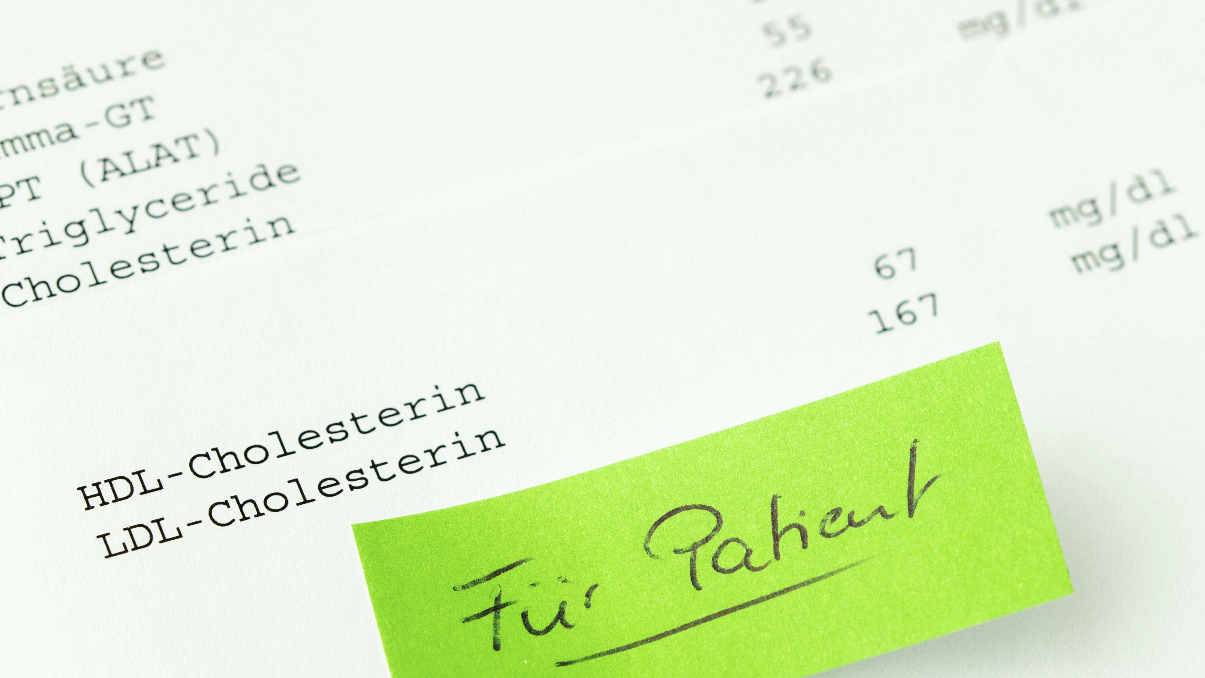 german Laboratory blood count for HDL and LDL cholesterol. word - Für Patient-for the patient on green sticky notes posted. Blood test for Blood Count. list of performed tests. Laboratory diagnostics