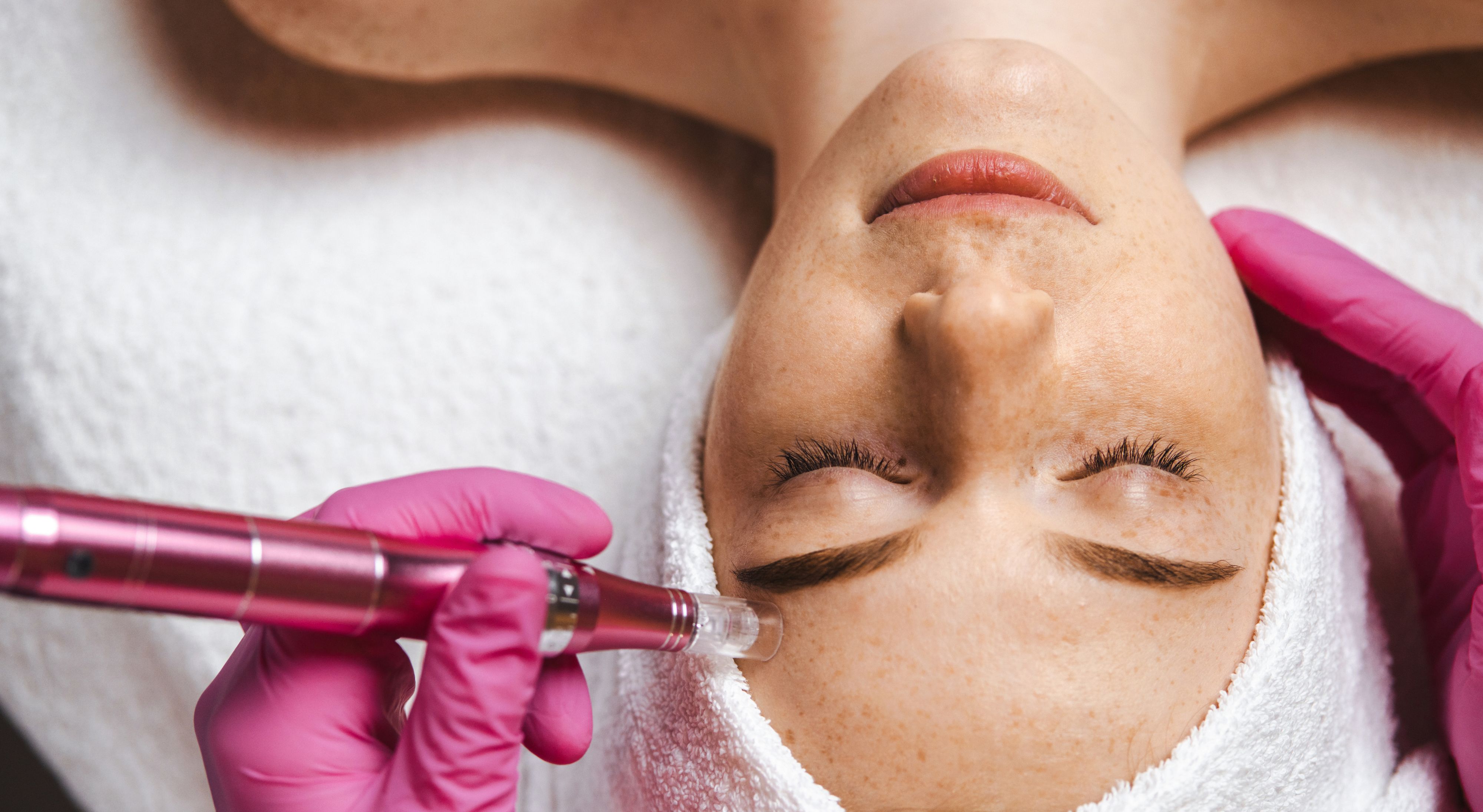 Treatments wie Microneedling können tatsächlich die Hautqualität verbessern.