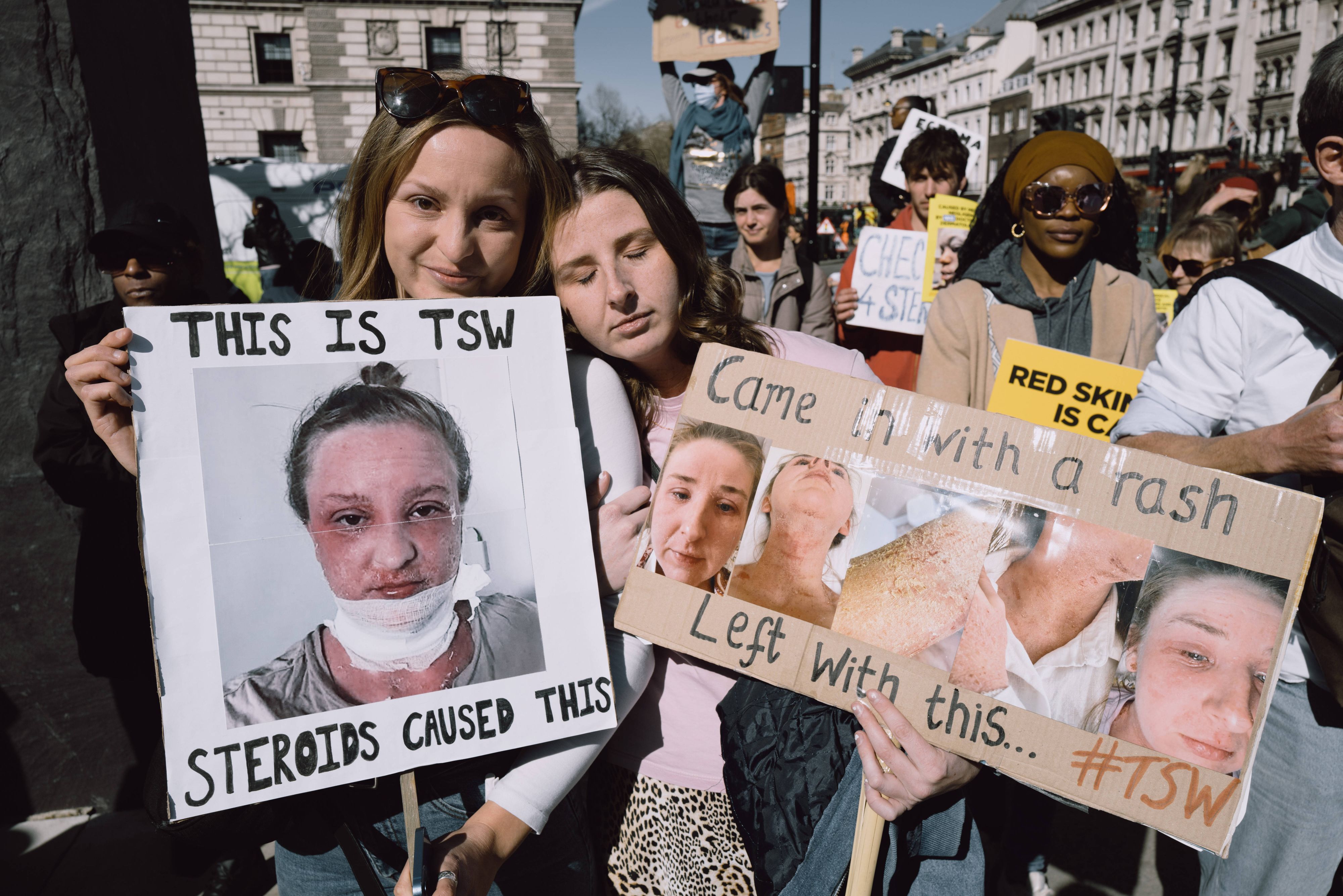 Heute.at - Unsere Haut fällt ab – und niemand kann sagen, warum