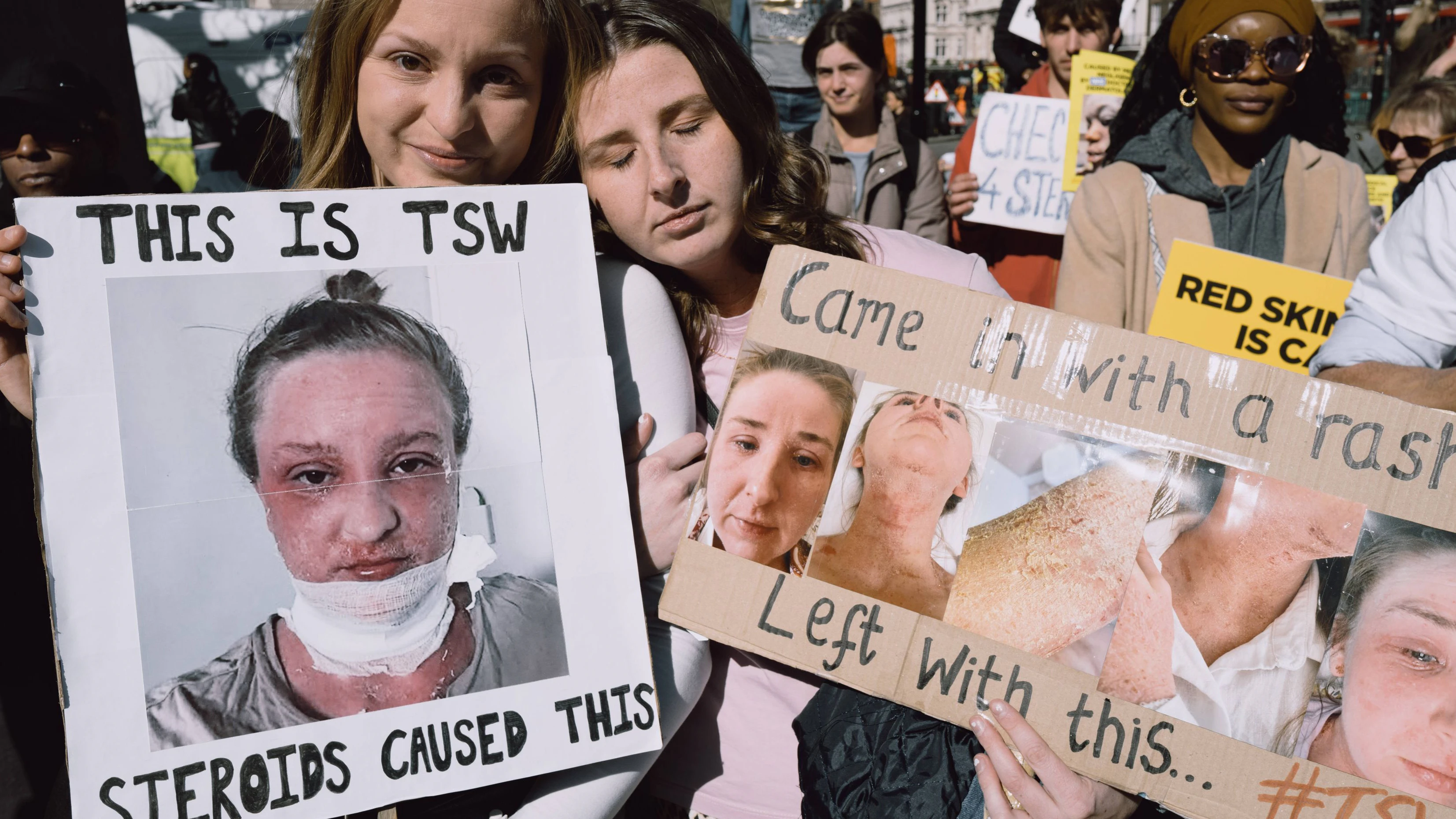 Heute.at - Unsere Haut fällt ab – und niemand kann sagen, warum