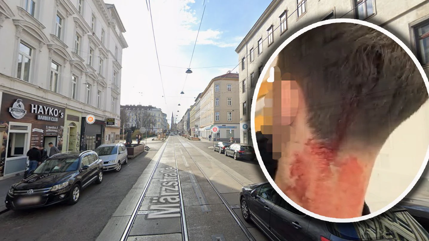 In den Kopf! Messer-Attacke auf Wiener vor Barber-Shop
