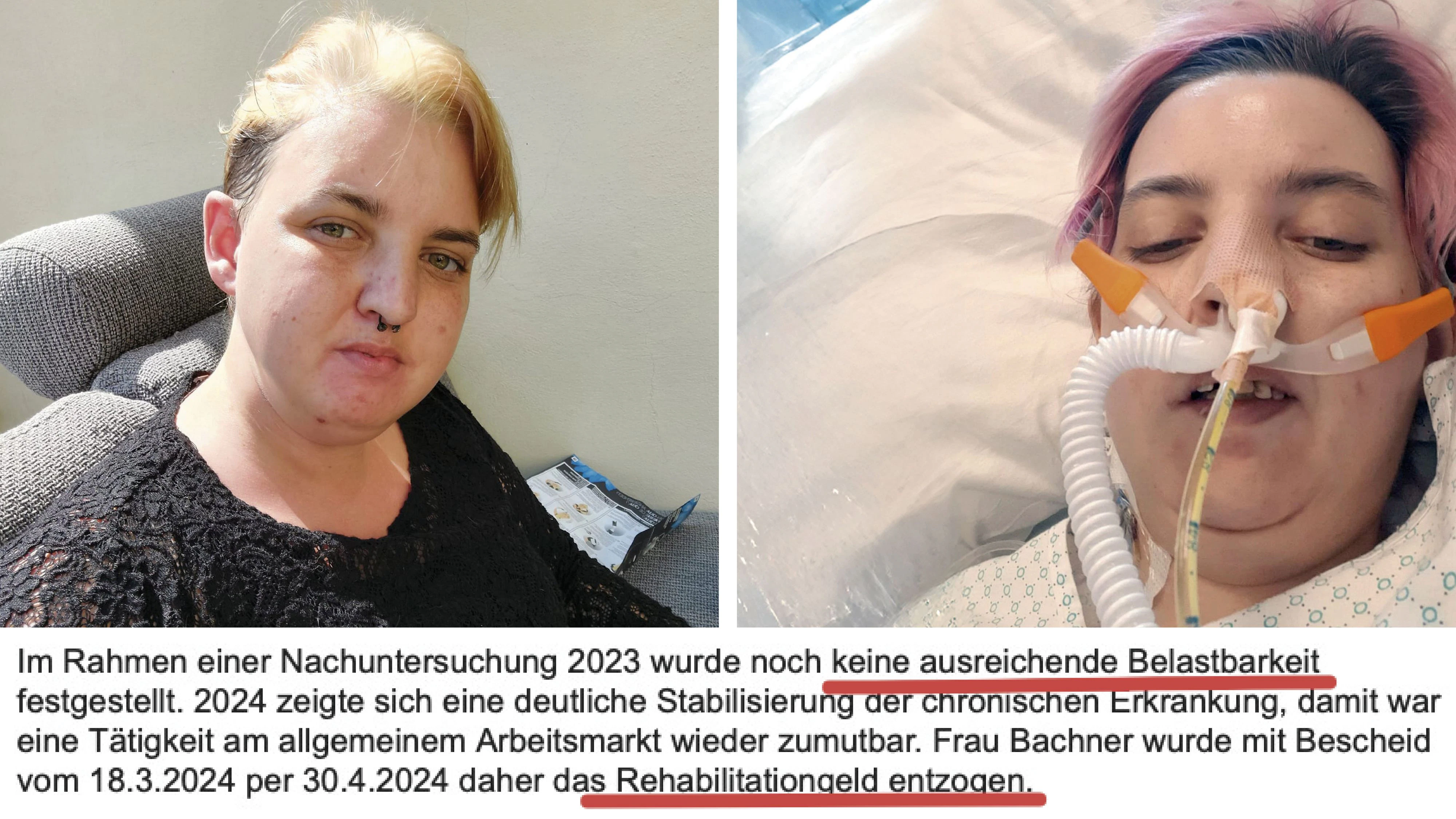 Natascha Bachner, PVA-Stellungnahme