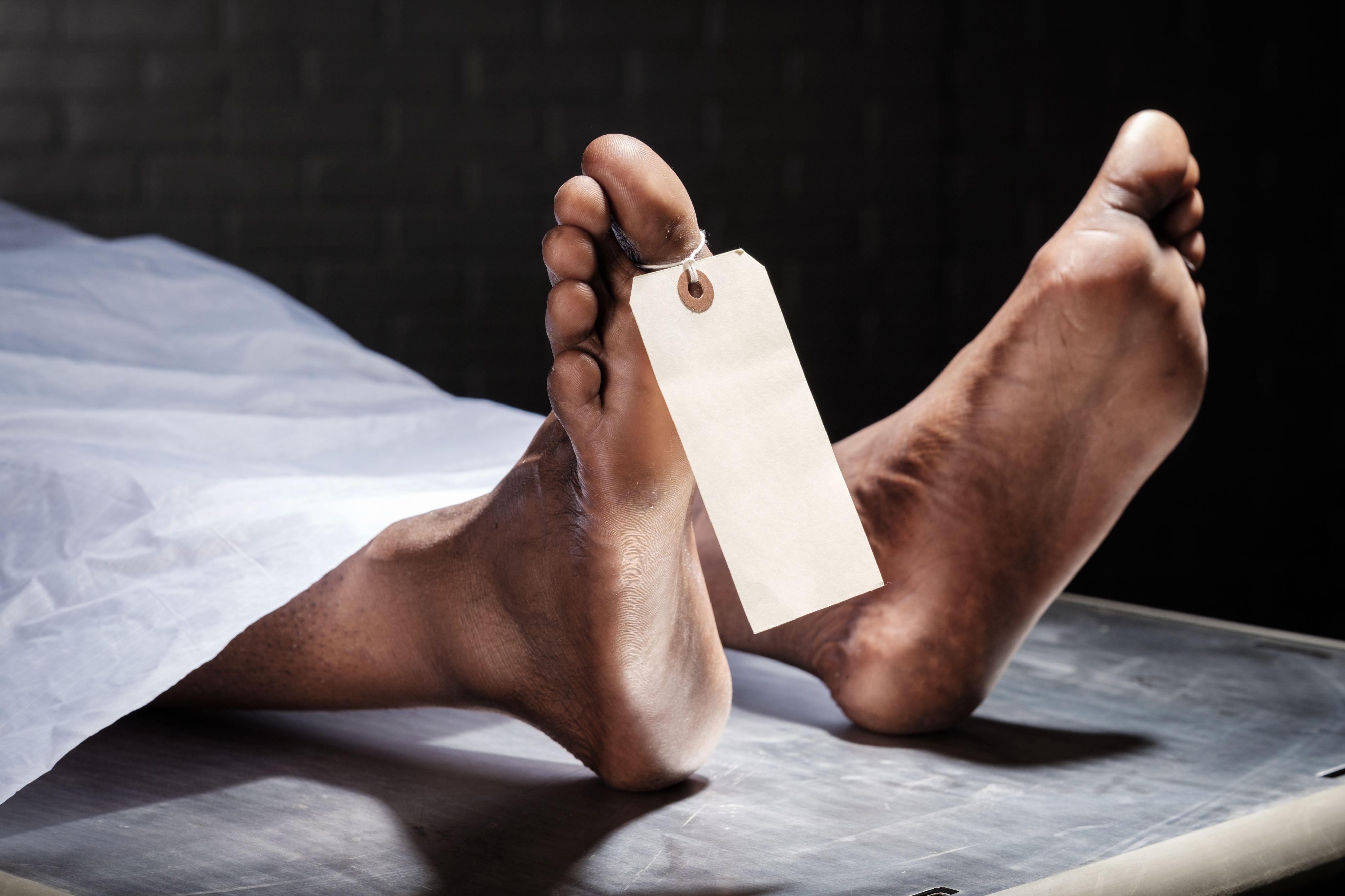 Immer mehr Menschen lassen sich Fett von Verstorbenen injizieren.