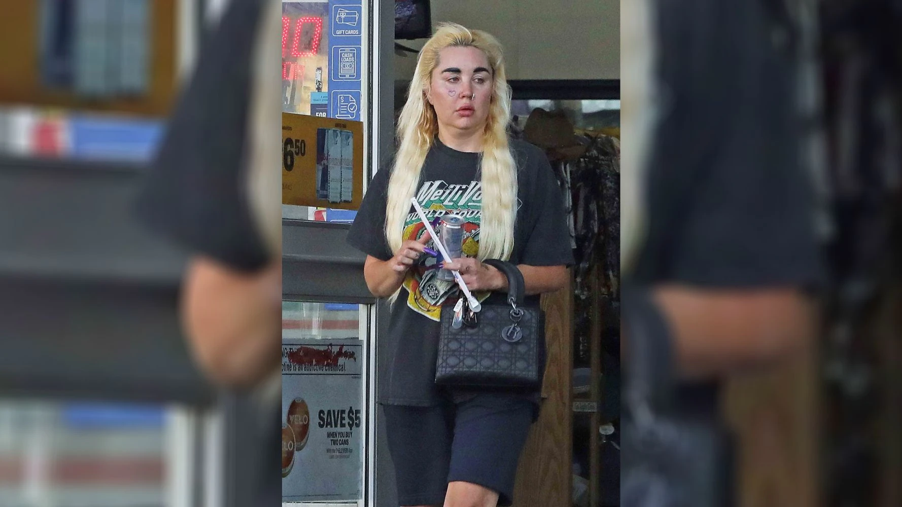 Hättest du diesen Teenie-Star erkannt?