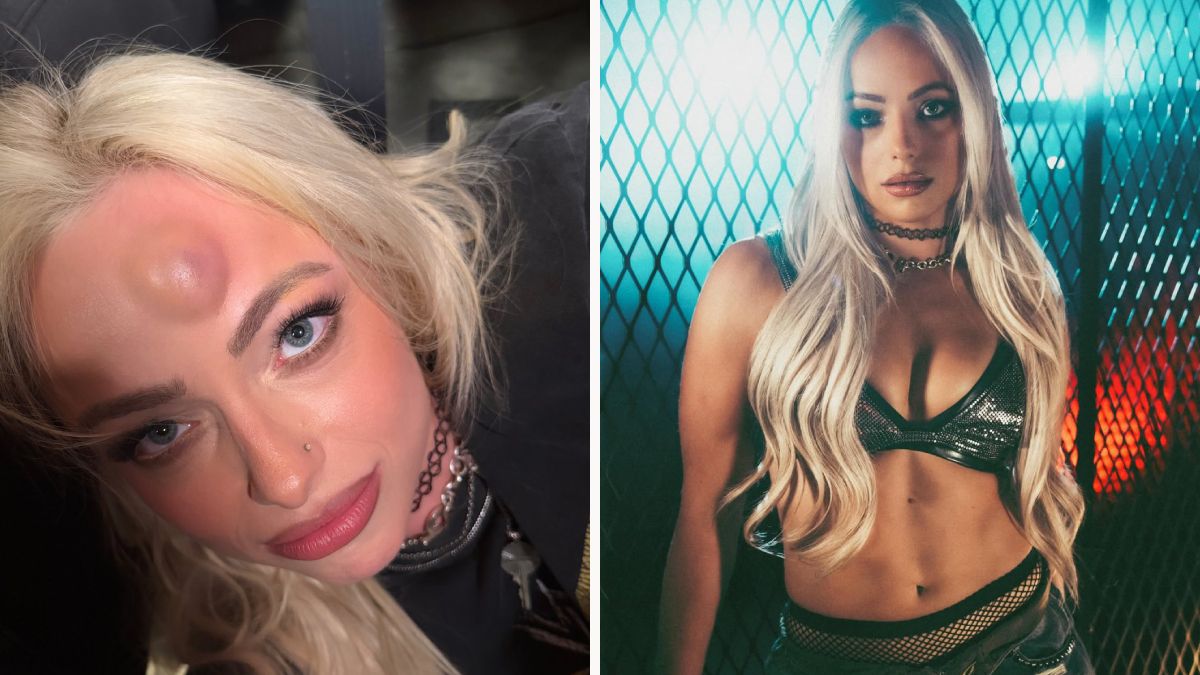 Liv Morgan mit Beule auf der Stirn.